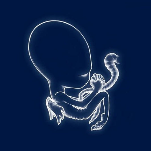 Sigur Ros - AGAETIS BYRJUN
